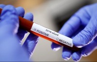 В Свердловской области за сутки +28 новых случаев коронавируса. Россия догоняет Китай по количеству инфицированных