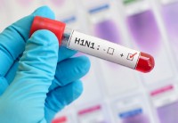 В Нижнем Тагиле зафиксирован случай заражения «свиным гриппом»