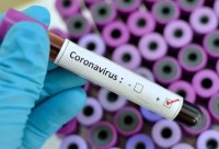 В Свердловской области на 10 июля +275 новых случаев коронавируса. Список городов