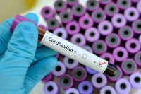 В Свердловской области на 7 августа +180 новых случаев коронавируса. В Нижнем Тагиле +16 заболевших