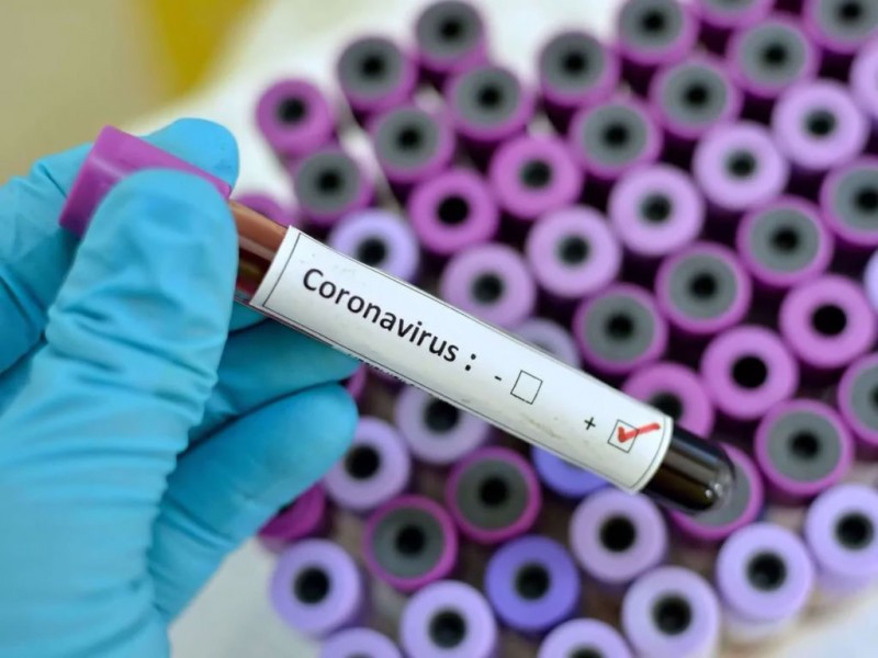 В Нижнем Тагиле 7 подтвержденных случаев коронавируса