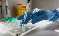 Роспотребнадзор: более половины тестов на коронавирус в части лабораторий ложные