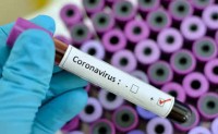 В Свердловской области на 9 мая +121 новый случай коронавируса. Список городов
