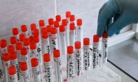 Три четверти заболевших коронавирусом в Свердловской области люди среднего возраста (статистика)